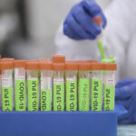 Covid Testing Stanford Lab