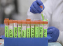 Marin’s Covid Stay-at-Home Order Goes Into Effect Tuesday Covid Testing Stanford Lab