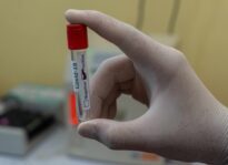 Marin County Partners With Testing Company for Pop-up Testing Covid-19 testing Marin County