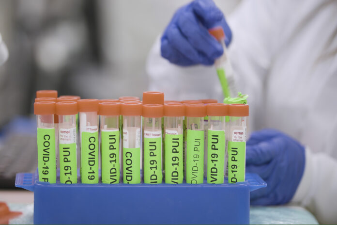 Roughly 11 Percent of Marin Residents Have Received First Covid-19 Vaccine Dose Steve Fisch Stanford Medicine