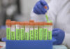 Covid testing - Steve Fisch/Stanford Medicine