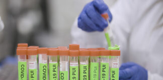 Covid testing - Steve Fisch/Stanford Medicine